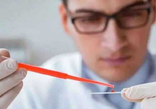 孕期乳头流出红色液体怎么办,健康护理要点指南